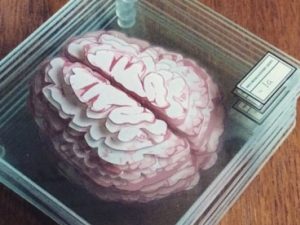 Brain Specimen Coasters | Million Dollar Gift Ideas