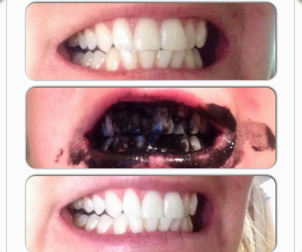Charcoal Teeth Whitening Toothpaste 2
