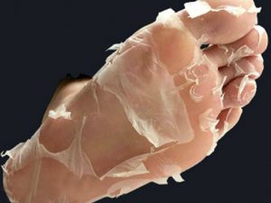 Deep Exfoliation Foot Peel | Million Dollar Gift Ideas