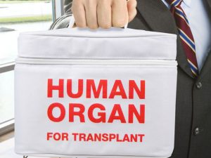 Human Organ Transport Lunch Bag | Million Dollar Gift Ideas